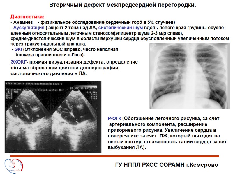ГУ НППЛ РХСС СОРАМН г.Кемерово Вторичный дефект межпредсердной перегородки. Диагностика:  Анамнез  